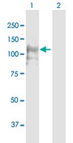 CNTROB Antibody in Western Blot (WB)