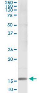 SH2D1B Antibody in Immunoprecipitation (IP)