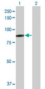 SSX2IP Antibody in Western Blot (WB)