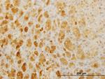 TWIST2 Antibody in Immunohistochemistry (Paraffin) (IHC (P))