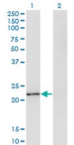 TWIST2 Antibody in Western Blot (WB)