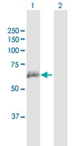 ANTXR2 Antibody in Western Blot (WB)