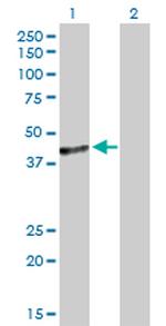 C10ORF4 Antibody in Western Blot (WB)