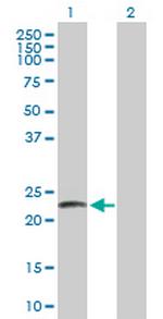 LYZL2 Antibody in Western Blot (WB)