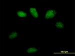 GSTO2 Antibody in Immunocytochemistry (ICC/IF)