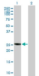 GSTO2 Antibody in Western Blot (WB)