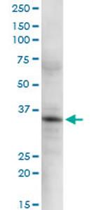 GSTO2 Antibody in Western Blot (WB)