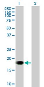 SLIC1 Antibody in Western Blot (WB)