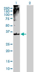 MSI2 Antibody in Western Blot (WB)