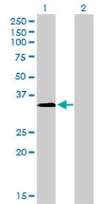 MSI2 Antibody in Western Blot (WB)