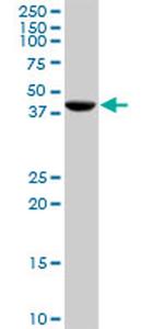 CANT1 Antibody in Western Blot (WB)