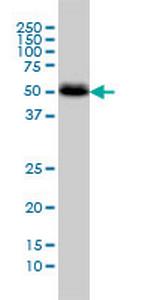 CANT1 Antibody in Western Blot (WB)