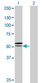 GGT6 Antibody in Western Blot (WB)