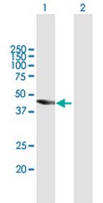 TBC1D16 Antibody in Western Blot (WB)