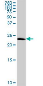 C1orf83 Antibody in Western Blot (WB)