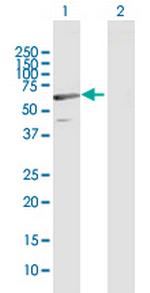 C1orf87 Antibody in Western Blot (WB)