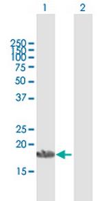 APOA1BP Antibody in Western Blot (WB)