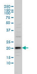 C20orf102 Antibody in Western Blot (WB)