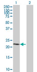 SIRPD Antibody in Western Blot (WB)