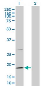 TAF8 Antibody in Western Blot (WB)