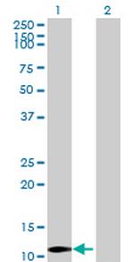 LYZL4 Antibody in Western Blot (WB)