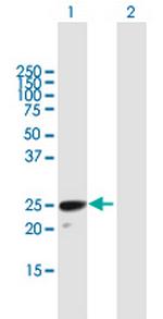 H1FOO Antibody in Western Blot (WB)