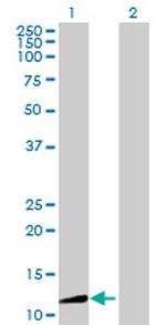 AASDH Antibody in Western Blot (WB)