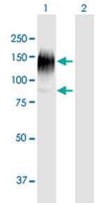 IL31RA Antibody in Western Blot (WB)