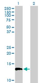 FLJ39155 Antibody in Western Blot (WB)