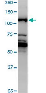 JMY Antibody in Western Blot (WB)