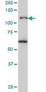 JMY Antibody in Western Blot (WB)