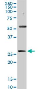 PACRG Antibody in Western Blot (WB)