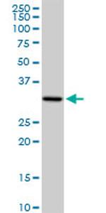 PACRG Antibody in Western Blot (WB)