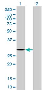 PACRG Antibody in Western Blot (WB)