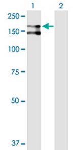 CD109 Antibody in Western Blot (WB)