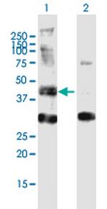 AGPAT6 Antibody in Western Blot (WB)