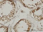 TAF1L Antibody in Immunohistochemistry (Paraffin) (IHC (P))