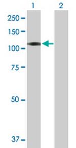 CXorf20 Antibody in Western Blot (WB)