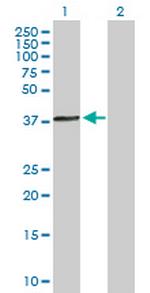 ACTRT1 Antibody in Western Blot (WB)