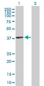 ACTRT2 Antibody in Western Blot (WB)