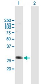 C5orf20 Antibody in Western Blot (WB)