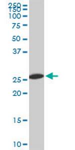 PSMA8 Antibody in Western Blot (WB)