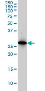 PSMA8 Antibody in Western Blot (WB)