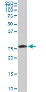 PSMA8 Antibody in Western Blot (WB)