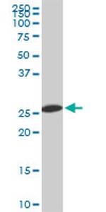 PSMA8 Antibody in Western Blot (WB)