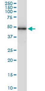 SESN3 Antibody in Western Blot (WB)