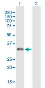 RAD9B Antibody in Western Blot (WB)