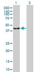 FLJ38725 Antibody in Western Blot (WB)