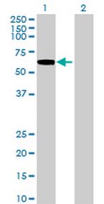 RP11-367C11.1 Antibody in Western Blot (WB)