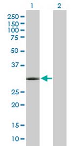 GSC Antibody in Western Blot (WB)